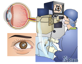 tutorial oveview