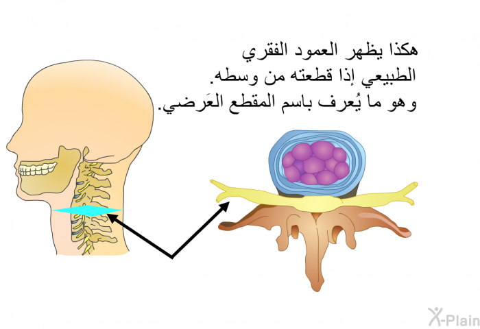 هكذا يظهر العمود الفقري الطبيعي إذا قطعته من وسطه. وهو ما يُعرف باسم المقطع العَرضي.