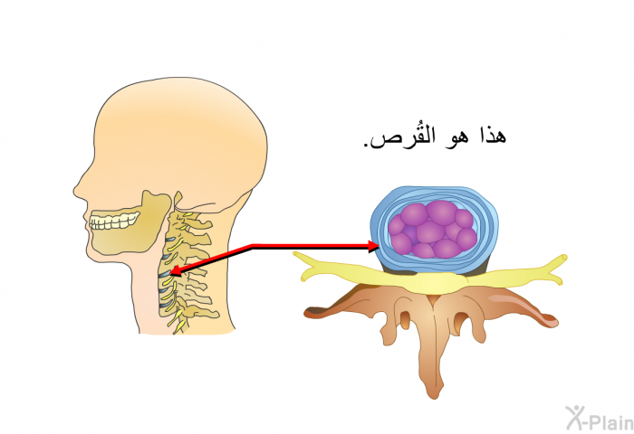 هذا هو القُرص.