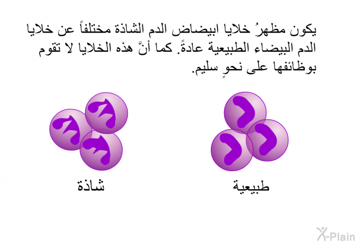 يكون مظهرُ خلايا ابيضاض الدم الشاذة مختلفاً عن خلايا الدم البيضاء الطبيعية عادةً. كما أنَّ هذه الخلايا لا تقوم بوظائفها على نحوٍ سليم.
