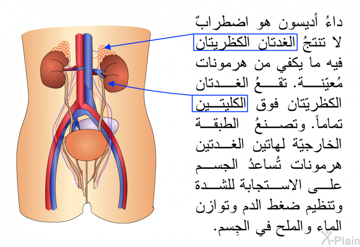 داءُ أديسون هو اضطرابٌ لا تنتجُ الغدتان الكظريتان فيه ما يكفي من هرمونات مُعيّنة. تقعُ الغدتان الكظريّتان فوق الكليتين تماماً. وتصنعُ الطبقة الخارجيّة لهاتين الغدتين هرمونات تُساعدُ الجسم على الاستجابة للشدة وتنظيم ضغط الدم وتوازن الماء والملح في الجِسم.