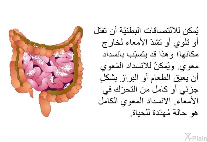 يُمكن للالتصاقات البطنيّة أن تفتل أو تلوي أو تشدّ الأمعاء لخارج مكانها؛ وهذا قد يتسبّب بانسداد معوي. ويُمكنُ للانسداد المَعوي أن يعيق الطعام أو البراز بشكلٍ جزئي أو كامل من التحرّك في الأمعاء. الانسداد المعوي الكامل هو حالة مُهدّدة للحياة.