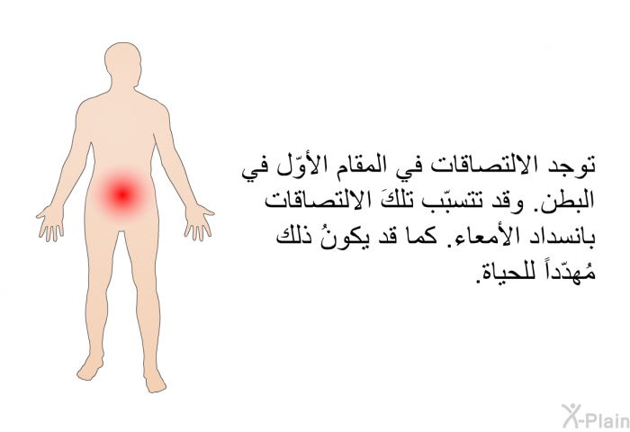 توجد الالتصاقات في المقام الأوّل في البطن. وقد تتسبّب تلكَ الالتصاقات بانسداد الأمعاء. كما قد يكونُ ذلك مُهدّداً للحياة.