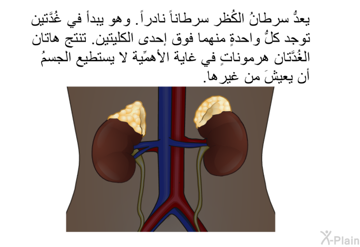 يعدُّ سرطانُ الكُظر سرطاناً نادراً. وهو يبدأ في غُدَّتين توجد كلُّ واحدةٍ منهما فوق إحدى الكليتين. تنتج هاتان الغُدَّتان هرموناتٍ في غاية الأهمِّية لا يستطيع الجسمُ أن يعيشَ من غيرها.