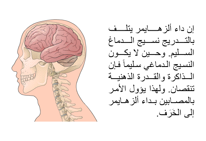 إن داء ألزهايمر يتلف بالتدريج نسيج الدماغ السليم. وحين لا يكون النسيج الدماغي سليماً فإن الذاكرة والقدرة الذهنية تنقصان. ولهذا يؤول الأمر بالمصابين بداء ألزهايمر إلى الخَرَف.