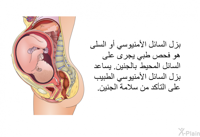 بزل السائل الأمنيوسي أو السلى هو فحص طبي يجرى على السائل المحيط بالجنين. يساعد بزل السائل الأمنيوسي الطبيب على التأكد من سلامة الجنين.