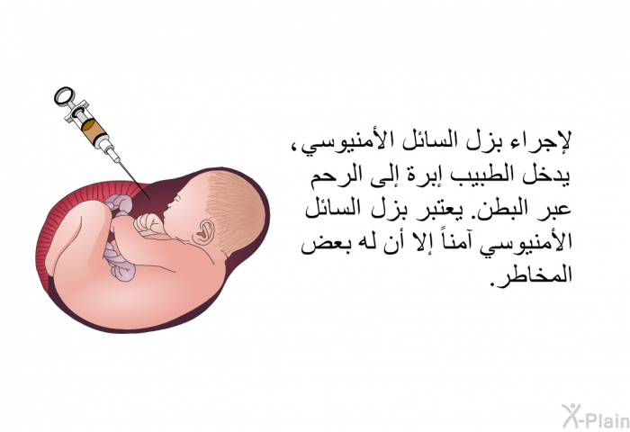 لإجراء بزل السائل الأمنيوسي ، يدخل الطبيب إبرة إلى الرحم عبر البطن. يعتبر بزل السائل الأمنيوسي آمنا إلا أن له بعض المخاطر.