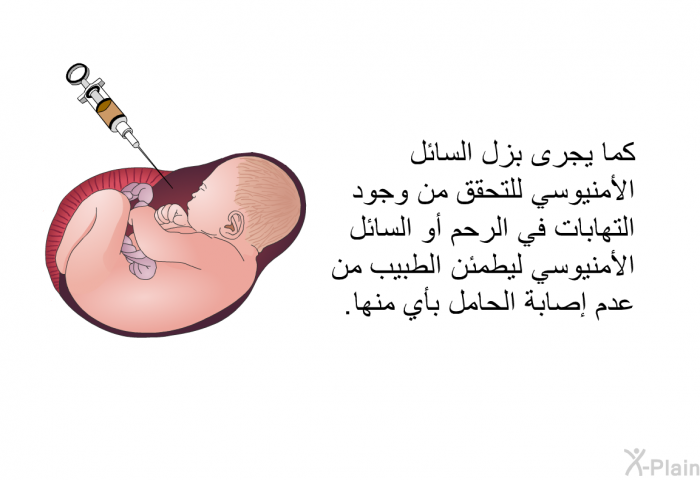 كما يجرى بزل السائل الأمنيوسي للتحقق من وجود التهابات في الرحم أو السائل الأمنيوسي ليطمئن الطبيب من عدم إصابة الحامل بأي منها.