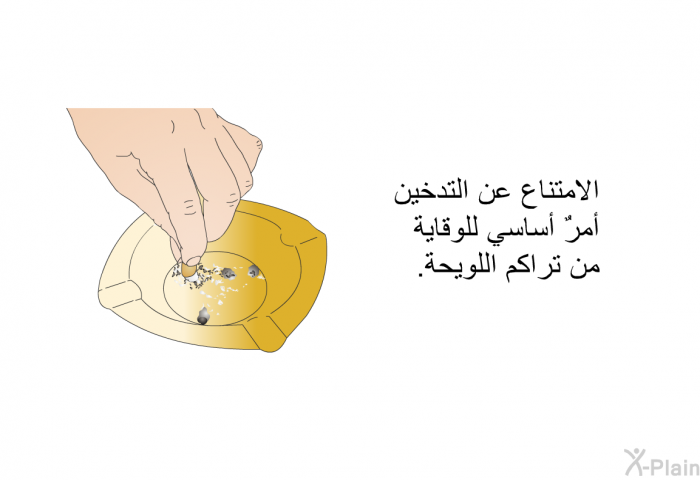 الامتناع عن التدخين أمرٌ أساسي للوقاية من تراكم اللويحة.