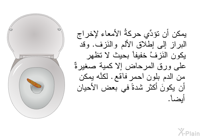 يمكن أن تؤدِّي حركةُ الأمعاء لإخراجِ البِراز إلى إطلاق الألم والنَزف. وقد يكون النَزفُ خفيفاً بحيث لا تظهر على ورق المرحاض إلاَّ كمية صغيرةٌ من الدم بلون احمر فاقع. لكنَّه يمكن أن يكونَ أكثر شدةً في بعض الأحيان أيضاً.