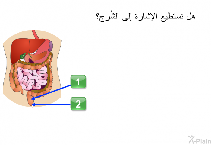 هل تستطيع الإشارة إلى الشَّرج؟