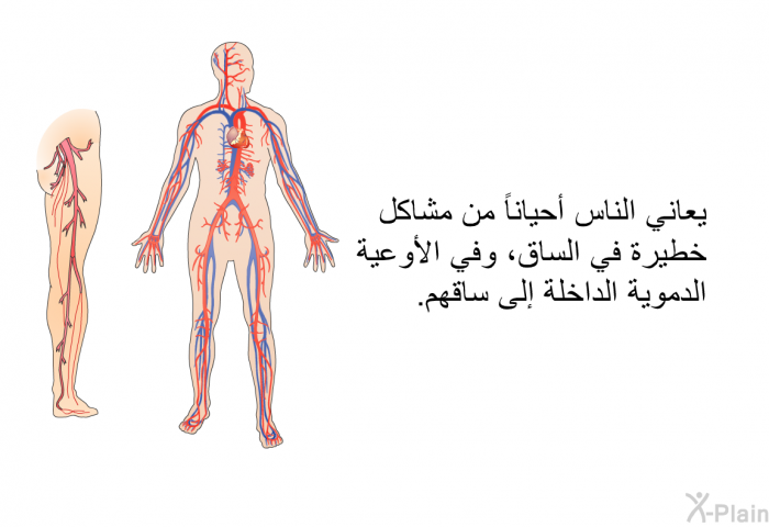 يعاني الناس أحياناً من مشاكل خطيرة في الساق، وفي الأوعية الدموية الداخلة إلى ساقهم.