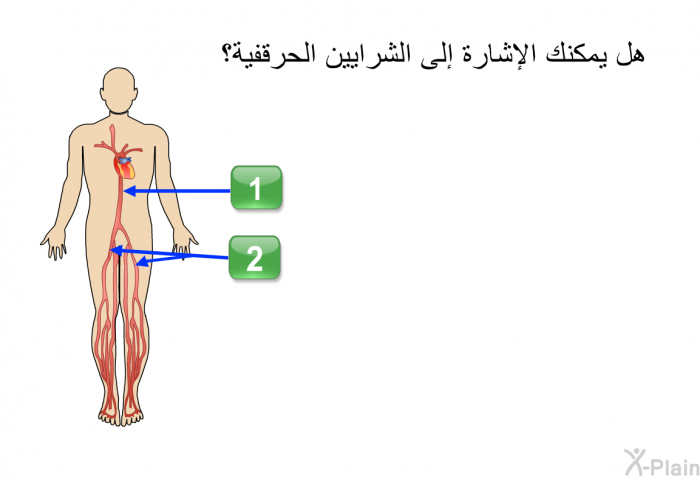 هل يمكنك الإشارة إلى الشرايين الحرقفية؟