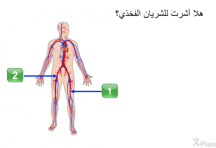 هلا أشرتَ للشريان الفخذي؟