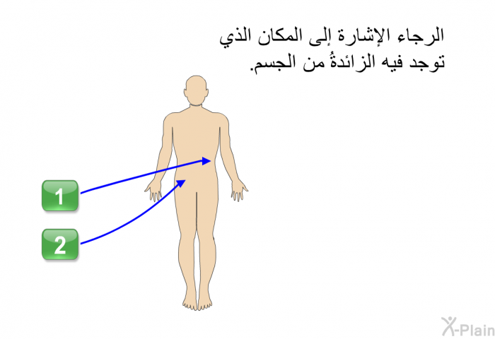 الرجاء الإشارة إلى المكان الذي توجد فيه الزائدةُ من الجسم.