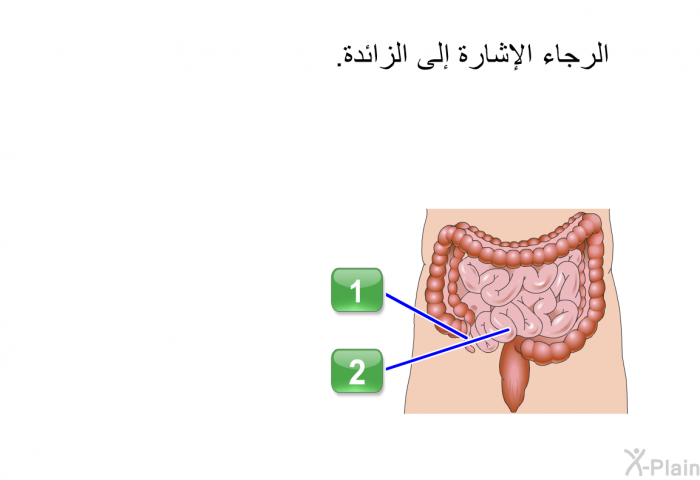 الرجاء الإشارة إلى الزائدة.