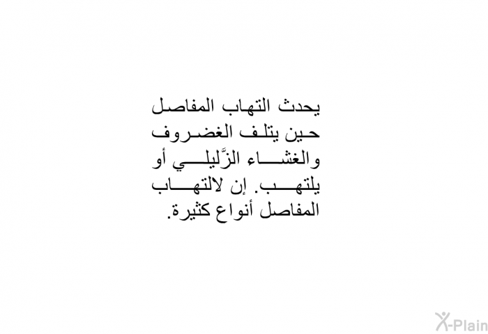 يحدث التهاب المفاصل حين يتلف الغضروف والغشاء الزَّليلي أو يلتهب. إن لالتهاب المفاصل أنواع كثيرة.