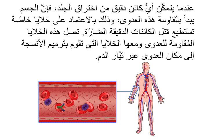 عندما يتمكَّن أيُّ كائن دقيق من اختراق الجلد، فإنَّ الجسم يبدأ بمُقاومة هذه العدوى، وذلك بالاعتماد على خلايا خاصَّة تستطيع قتل الكائنات الدقيقة الضارَّة. تصل هذه الخلايا المُقاومة للعدوى ومعها الخلايا التي تقوم بترميم الأنسجة إلى مكان العدوى عبر تيَّار الدم.