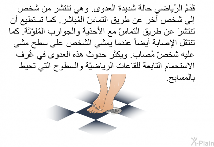 قَدَمُ الرِّياضي حالة شديدة العدوى. وهي تنتشر من شخص إلى شخص آخر عن طريق التماسِّ المُباشر. كما تستطيع أن تنتشرَ عن طريق التماسِّ مع الأحذية والجوارب المُلوَّثة. كما تنتقل الإصابة أيضاً عندما يمشي الشخص على سطح مشى عليه شخصٌ مُصاب. ويكثر حدوث هذه العدوى في غُرف الاستحمام التابعة للقاعات الرياضيَّة والسطوح التي تحيط بالمسابح.