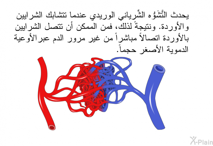 يحدث التَّشَوُّه الشِّرياني الوريدي عندما تتشابك الشرايين والأوردة. ونتيجةً لذلك، فمن الممكن أن تتصل الشرايين بالأوردة اتصالاً مباشراً من غير مرور الدم عبر الأوعية الدموية الأصغر حجماً.