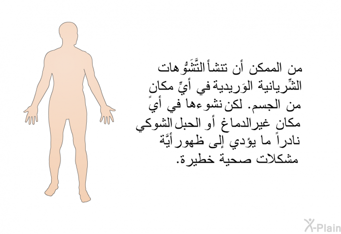 من الممكن أن تنشأ التَّشَوُّهات الشِّريانية الوَريدية في أيِّ مكانٍ من الجسم. لكنَّ نشوءَها في أي مكانٍ غير الدماغ أو الحبل الشوكي نادراً ما يؤدي إلى ظهور أيَّة مشكلات صحية خطيرة.