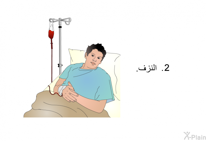 النزف.