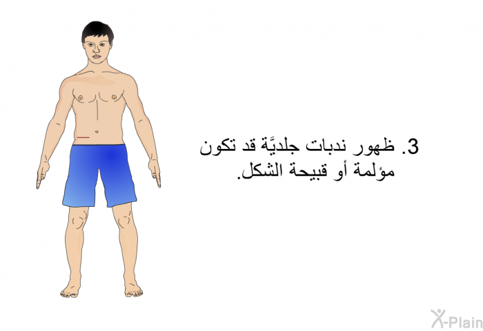 ظهور ندبات جلديَّة قد تكون مؤلمة أو قبيحة الشكل.