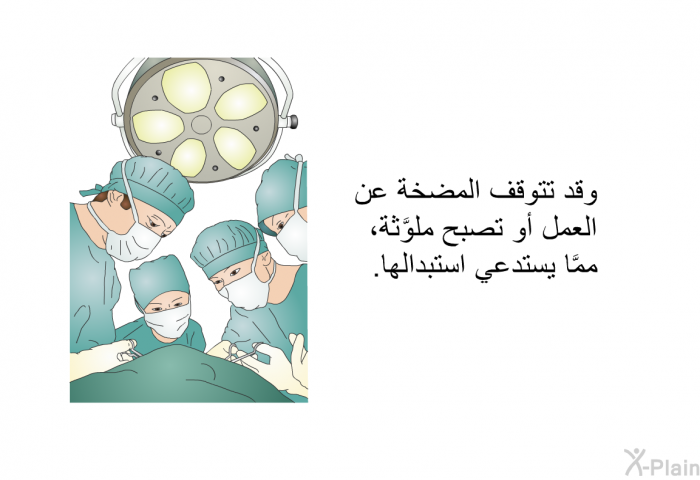 وقد تتوقَّف المضخَّةُ عن العمل أو تصبح ملوَّثة، ممَّا يستدعي استبدالها.