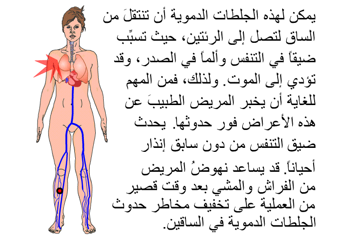 يمكن لهذه الجلطات الدموية أن تنتقلَ من الساق لتصل إلى الرئتين، حيث تسبِّب ضيقاً في التنفس وألماً في الصدر، وقد تؤدي إلى الموت. ولذلك، فمن المهم للغاية أن يخبر المريض الطبيبَ عن هذه الأعراض فور حدوثها. يحدث ضيق التنفُّس من دون سابق إنذار أحياناً. قد يساعد نهوضُ المريض من الفراش والمشي بعد وقت قصير من العملية على تخفيف مخاطر حدوث الجلطات الدموية في الساقين.