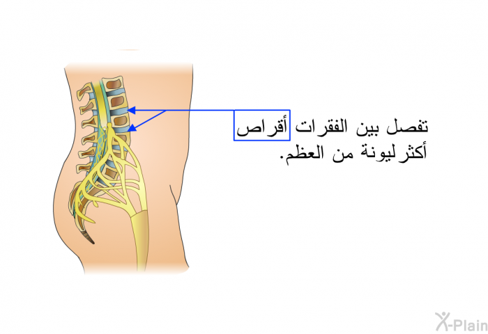 تفصل بين الفقرات أقراص ليونة من العظم.