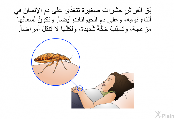 بَق الفِراشِ حشرات صغيرة تتغذَّى على دمِ الإنسانِ في أثناءِ نومِه، وعلى دمِ الحيواناتِ أيضاً. وتكونُ لسعاتُها مزعجةً، وتسبِّبُ حَكَّةً شَديدة، ولكنَّها لا تنقلُ أمراضاً.