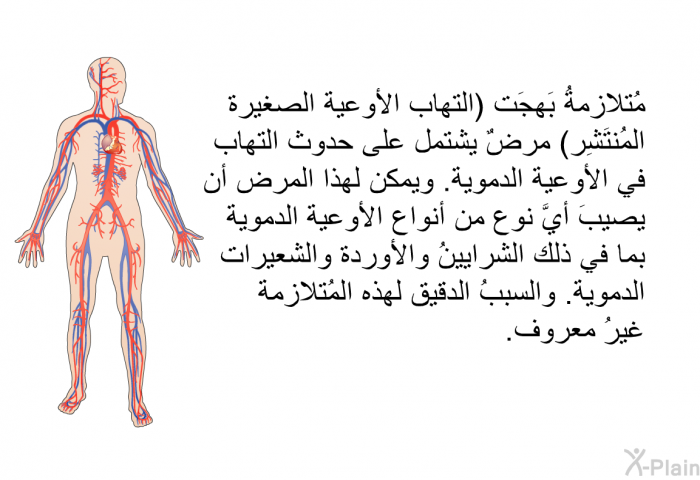 مُتلازِمةُ بَهجَت (التهاب الأوعية الصغيرة المُنْتَشِر) مرضٌ يشتمل على حدوث التهاب في الأوعية الدموية. ويمكن لهذا المرض أن يصيبَ أيَّ نوعٍ من أنواع الأوعية الدموية، بما في ذلك الشرايينُ والأوردة والشعيرات الدموية. والسببُ الدقيق لهذه المُتلازِمة غيرُ معروف.