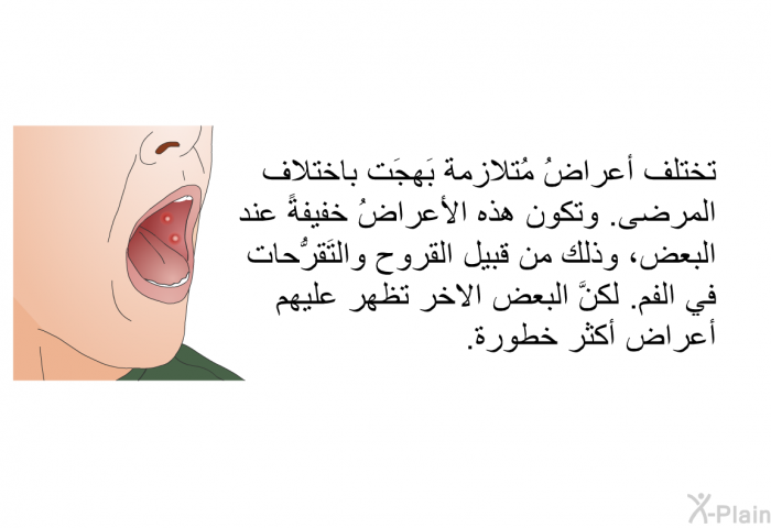 تختلف أعراضُ مُتلازِمة بَهجَت باختلاف المرضى. وتكون هذه الأعراضُ خفيفةً عند البعض، وذلك من قبيل القروح والتَقرُّحات في الفم. لكنَّ البعض الاخر تظهر عليهم أعراض أكثر خطورة.