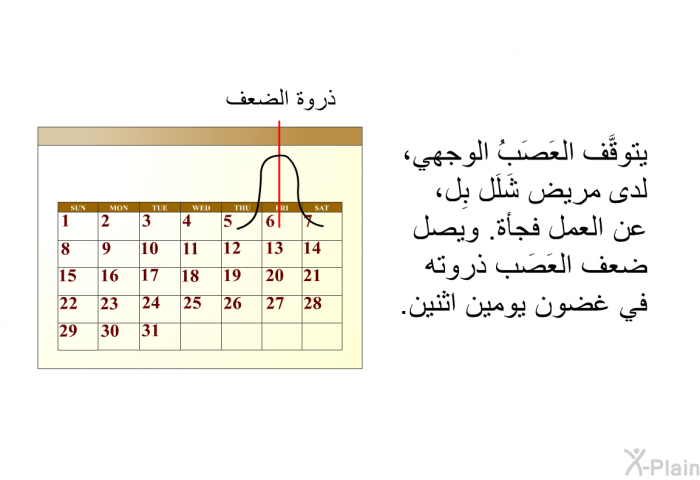 يتوقَّف العَصَبُ الوجهي، لدى مريض شَلَل بِل، عن العمل فجأة. ويصل ضعف العَصَب ذروته في غضون يومين اثنين.