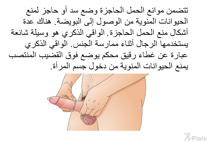 تتضمن موانع الحمل الحاجزة وضع سد أو حاجز لمنع الحيوانات المنوية من الوصول إلى البويضة. هناك عدة أشكال منع الحمل الحاجزة. الواقي الذكري هو وسيلة شائعة يستخدمها الرجال أثناء ممارسة الجنس. الواقي الذكري عبارة عن غطاء رقيق محكم يوضع فوق القضيب المنتصب. يمنع الحيوانات المنوية من دخول جسم المرأة.