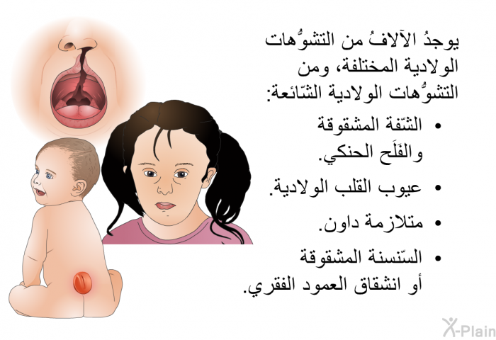 يوجدُ الآلافُ من التشوُّهات الولادية المختلفة، ومن التشوُّهات الولادية الشّائعة:  الشّفة المشقوقة والفَلَح الحنكي. عيوب القلب الولادية. متلازمة داون. السّنسنة المشقوقة أو انشقاق العمود الفقري.