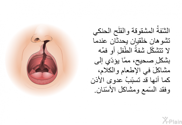 الشّفةُ المشقوقة والفَلَح الحنكي تشوهان خلقيان يحدثان عندما لا تتشكّل شفةُ الطّفلِ أو فمُه بشكلٍ صحيح، ممَّا يؤدّي إلى مشاكلَ في الإطعام والكلام، كما أنها قد تسبّبُ عدوى الأذن وفقد السّمع ومشاكل الأسّنان.