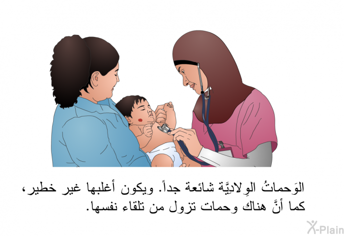 الوَحماتُ الوِلادِيَّة شائعة جداً. ويكون أغلبها غير خطير، كما أنَّ هناك وَحمات تزول من تلقاء نفسها.