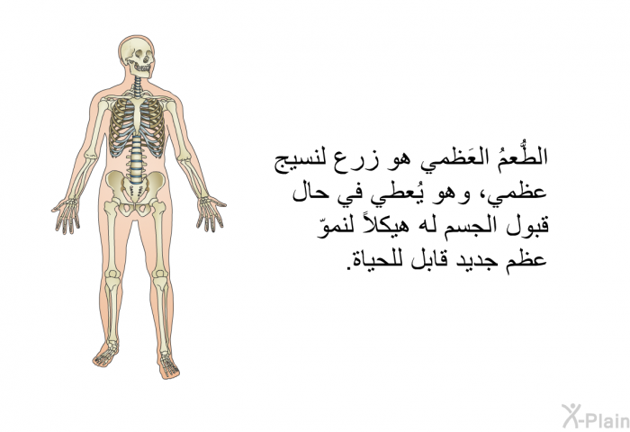 الطُّعمُ العَظمي هو زرع لنسيج عظمي، وهو يُعطي في حال قبول الجسم له هيكلاً لنموّ عظم جديد قابل للحياة.