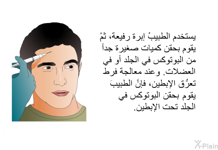 يستخدم الطبيبُ إبرة رفيعة، ثمَّ يقوم بحقن كميات صغيرة جداً من البوتوكس في الجلد أو في العضلات. وعند معالجة فرط تعرُّق الإبطين، فإنَّ الطبيبَ يقوم بحقن البوتوكس في الجلد تحت الإبطين.