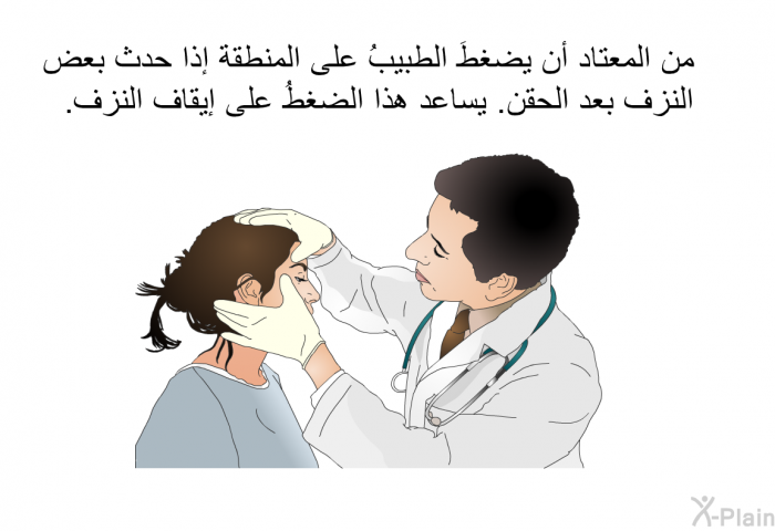 من المعتاد أن يضغطَ الطبيبُ على المنطقة إذا حدث بعض النزف بعد الحقن. يساعد هذا الضغطُ على إيقاف النزف.