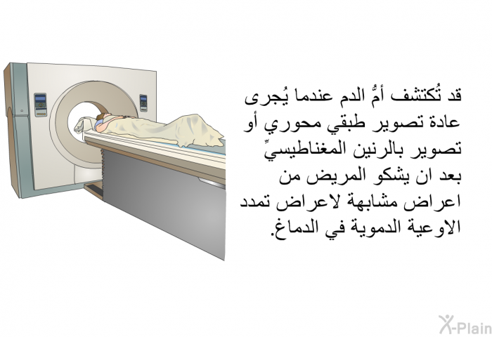 قد تُكتشف أمُّ الدم عندما يُجرى عادة تصوير طبقي محوري أو تصوير بالرنين المغناطيسيِّ بعد ان يشكو المريض من اعراض مشابهة لاعراض تمدد الاوعية الدموية في الدماغ.