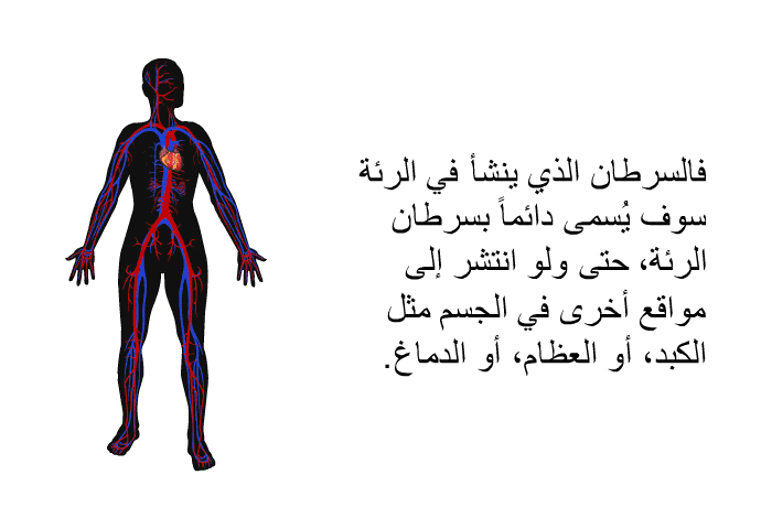 فالسرطان الذي ينشأ في الرئة سوف يُسمى دائماً بسرطان الرئة، حتى ولو انتشر إلى مواقع أخرى في الجسم مثل الكبد، أو العظام، أو الدماغ.