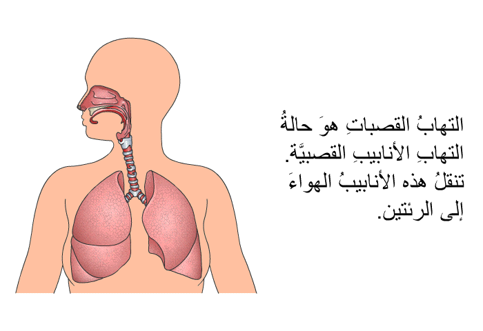 التهابُ القصباتِ هوَ حالةُ التهابِ الأنابيبِ القصبيَّة. تنقلُ هذه الأنابيبُ الهواءَ إلى الرئتين.