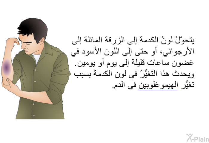 يتحوَّلُ لونُ الكدمة إلى الزرقة المائلة إلى الأرجواني، أو حتى إلى اللون الأسود في غضون ساعات قليلة إلى يوم أو يومين. ويحدث هذا التغيُّرُ في لون الكدمة بسبب تغيُّر الهيموغلوبين في الدم.