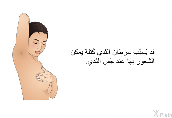 قد يُسبِّب سرطان الثدي كُتلة يمكن الشعور بها عند جَس الثدي.