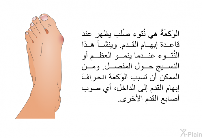 الوَكعَةُ هي نُتوء صُلب يظهر عند قاعدة إبهام القدم. وينشأ هذا النُتوء عندما ينمو العظمُ أو النسيج حول المفصل. ومن الممكن أن تسبب الوَكعَة انحرافَ إبهام القدم إلى الداخل، أي صوب أصابع القدم الأخرى.