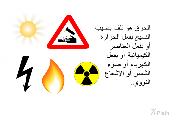 الحرق هو تلف يصيب النسيج بفعل الحرارة أو بفعل العناصر الكيماوية أو بفعل الكهرباء أو ضوء الشمس أو الإشعاع النووي<B>.</B>