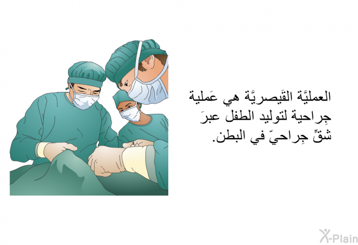العمليَّة القَيصريَّة هي عَملية جِراحية لتوليد الطفل عبرَ شقٍّ جِراحيّ في البطن.