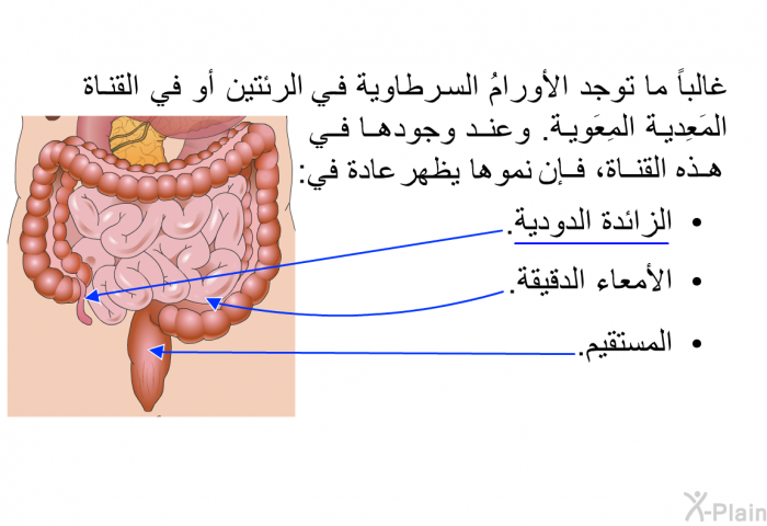 غالباً ما توجد الأورامُ السرطاوية في الرئتين أو في القناة المَعِدية المِعَوية. وعند وجودها في هذه القناة، فإن نموها يظهر عادة في:   الزائدة الدودية.  الأمعاء الدقيقة. المستقيم.